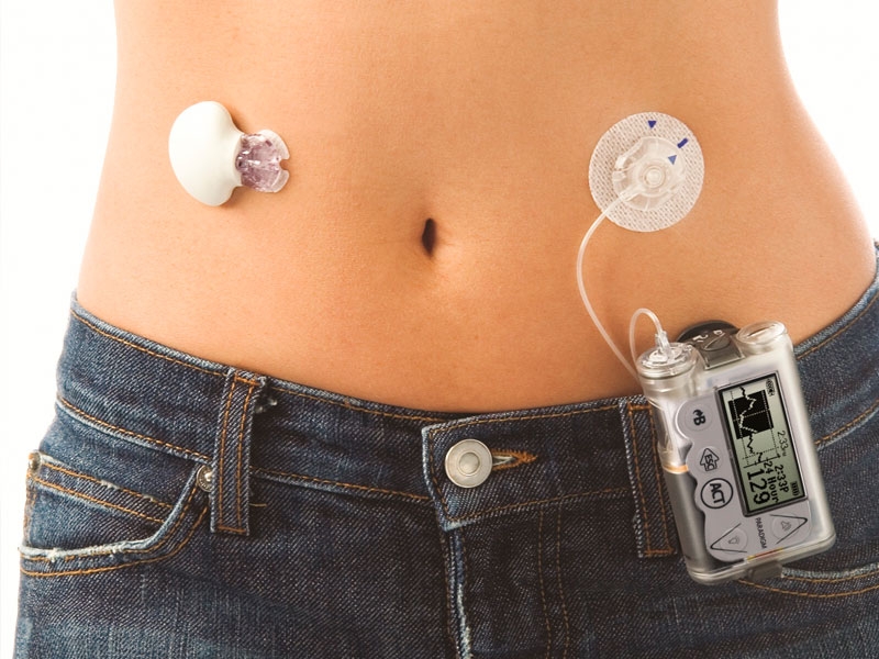 0_monitor-continuo-de-glucemia.jpg